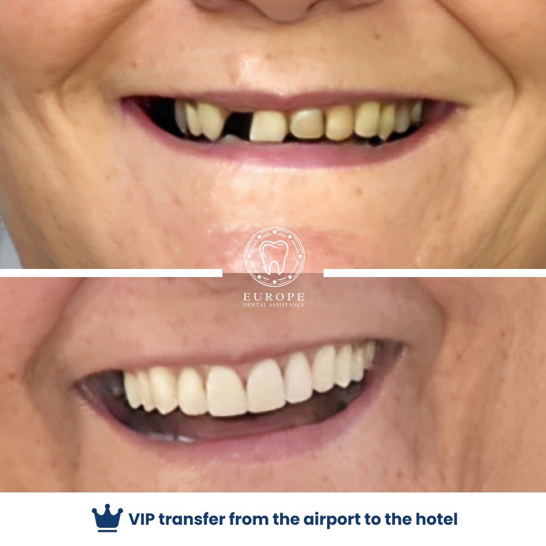 WhatsApp Image 2025-08-04 at 21.01.21 (3)