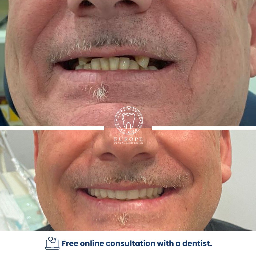 WhatsApp Image 2025-08-04 at 21.01.21 (4)