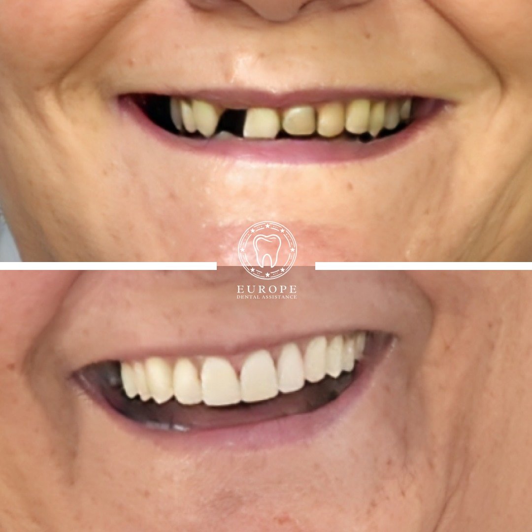 WhatsApp Image 2025-12-01 at 17.15.07