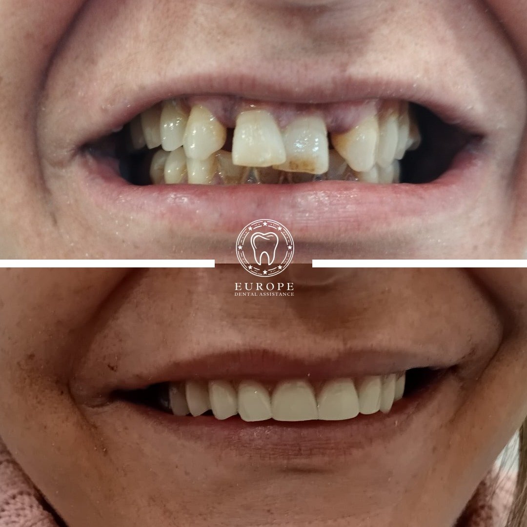 WhatsApp Image 2025-12-01 at 17.15.08